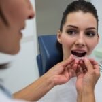Invisalign for Modern Teeth Alignment