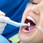 Tooth Restoration