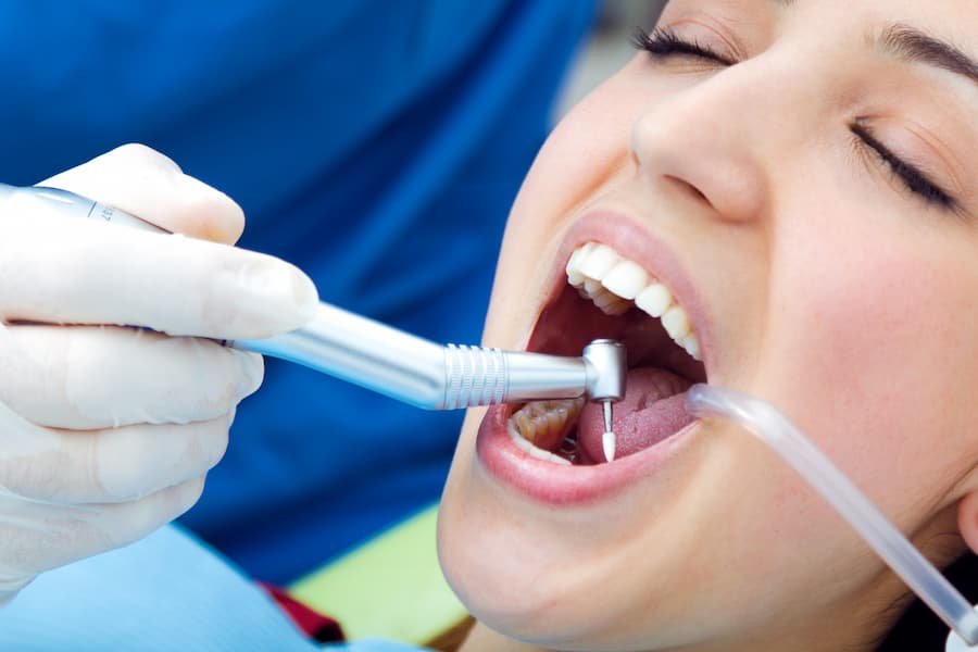 Tooth Restoration